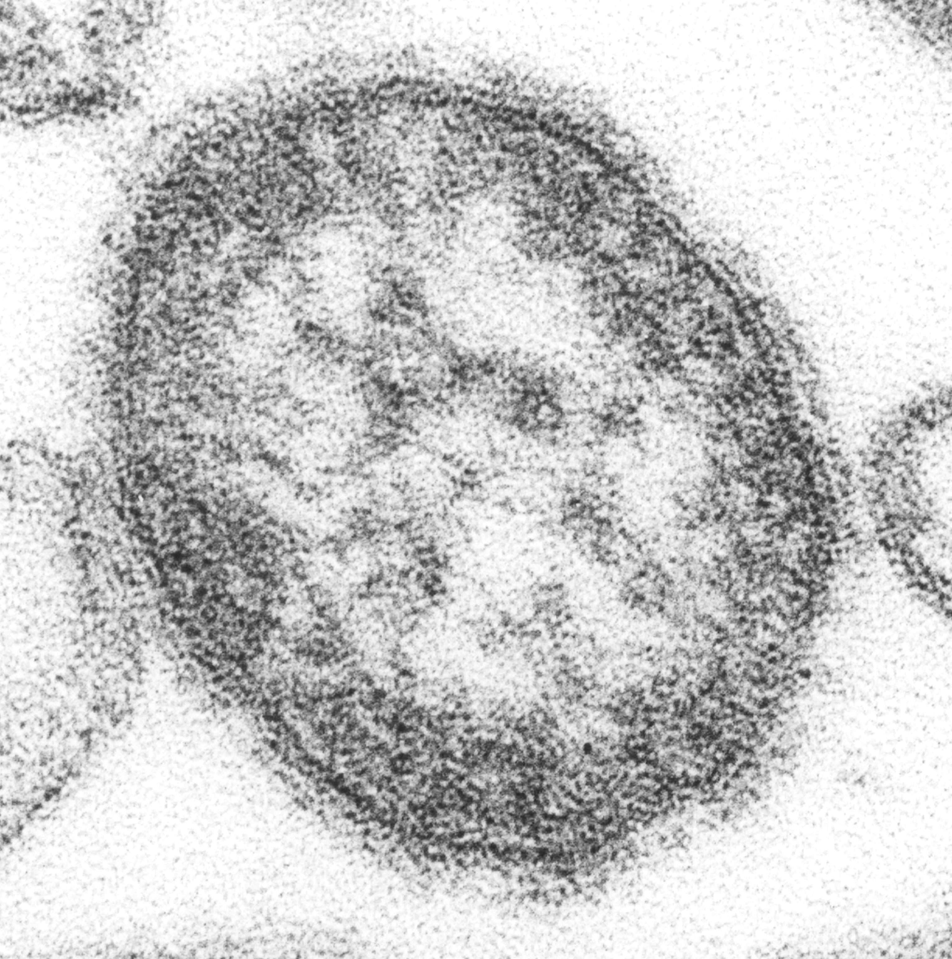 TEM-Aufnahme eines Masernvirus